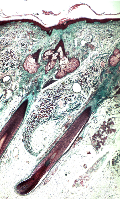 Section of human scalp skin