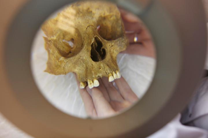 Image of a skull