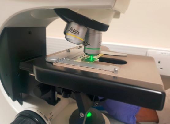 Microscope with laser light pointed at slide Microscope with laser light pointed at slide
