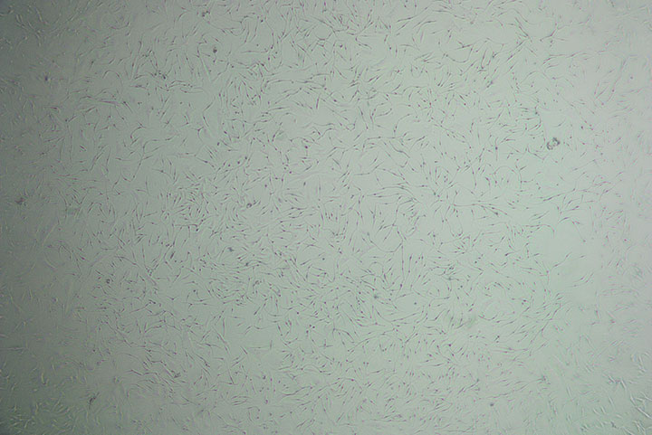 Microscope image of cultured human epidermal melanocytes in vitro Microscope image of cultured human epidermal melanocytes in vitro
