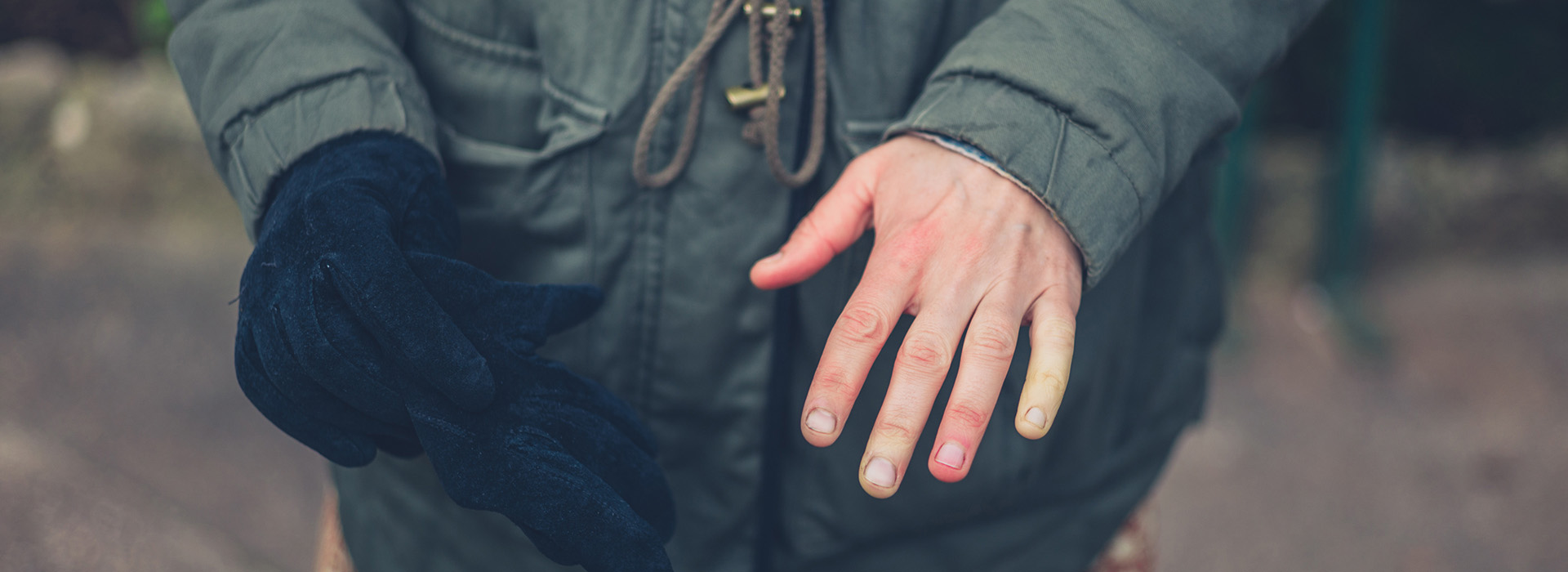 A person with Raynaud's showing out their white fingers because of the disease