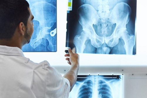 A radiography student evaluating an X-ray of a patient's hip region on a wall mounted light box.