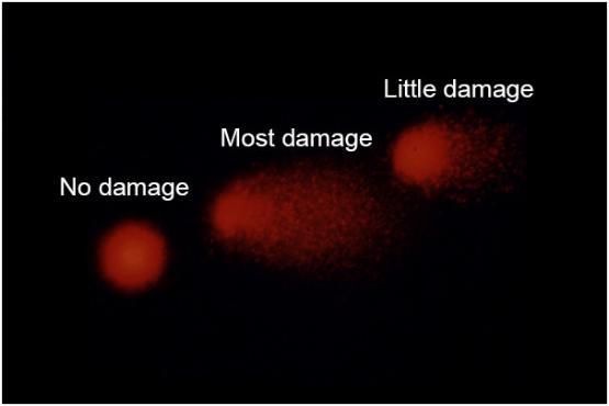 DNA damage in Blood Lymphocytes in the Comet Assay 