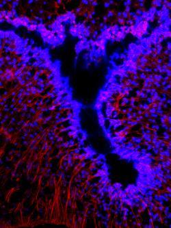 Tanycytes, specialised glial cells in the hypothalamus are important in body weight regulation. The image shows tanycytes lining the third ventricle of the hypothalamus and was taken during an undergraduate student (H.Uddin, 3rd year project student 2017)