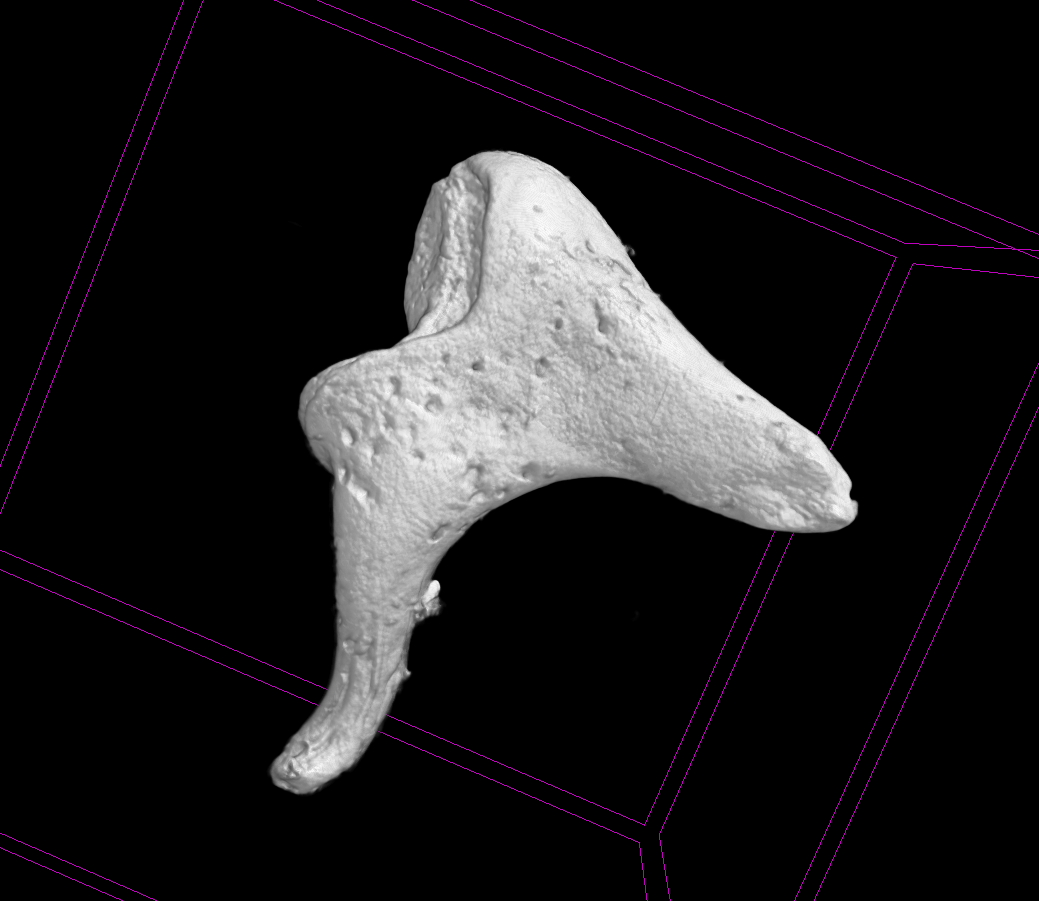 Closeup of ear ossicle on a black background with blue 3D lines.