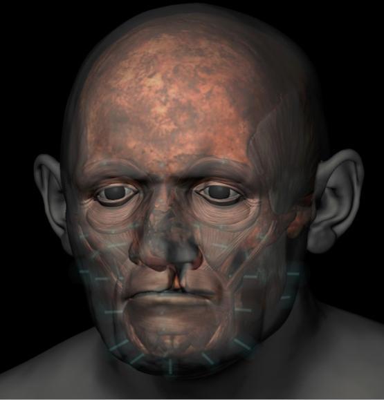 3D rendering of 'hair lipped priest' with muscle layers