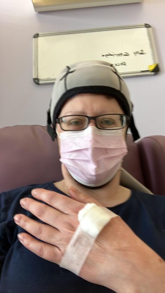 wearing a cooling cap during cancer treatment