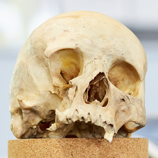 Human skull resting on cork display.
